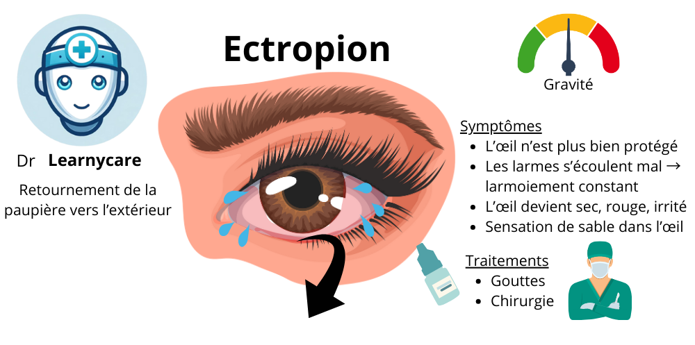 Ectropion infographie Dr Learnycare