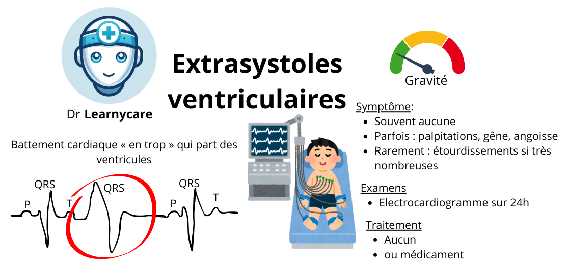 Extrasystoles ventriculaires infographie Dr Learnycare
