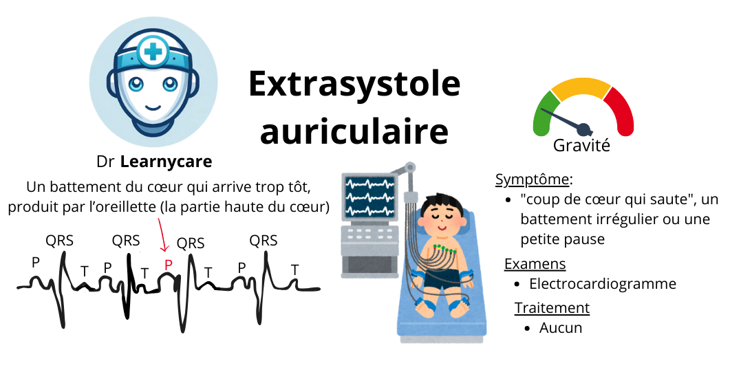 Extrasystole auriculaire infographie Dr Learnycare