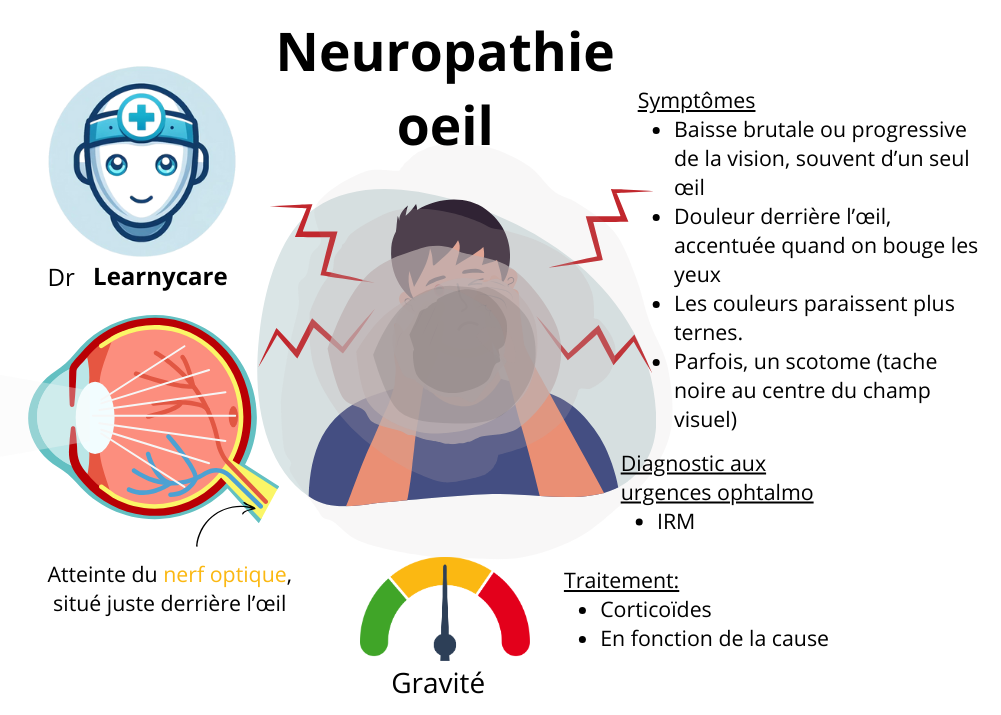 Neuropathie optique rétro bulbaire infographie Dr Learnycare