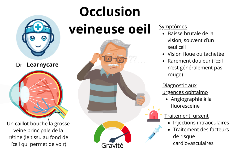 Occlusion veineuse centrale de rétine infographie Dr Learnycare