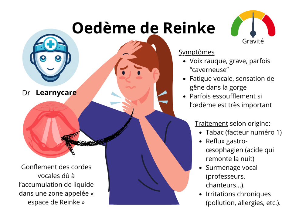 Œdème de Reinke infographie Dr Learnycare