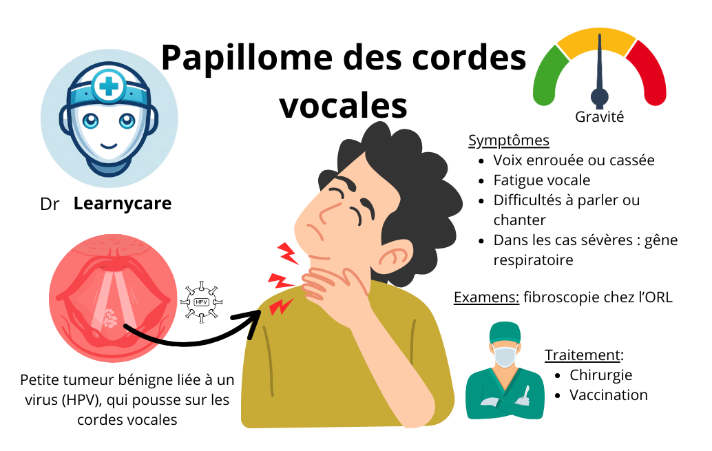 Papillome des cordes vocales infographie Dr Learnycare