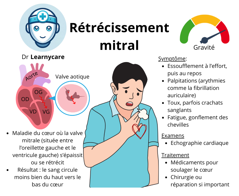 Rétrécissement mitral Dr Learnycare
