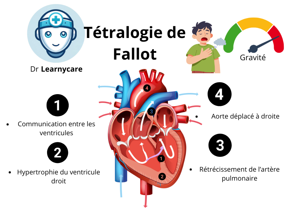 Tétralogie de Fallot infographie Dr Learnycare