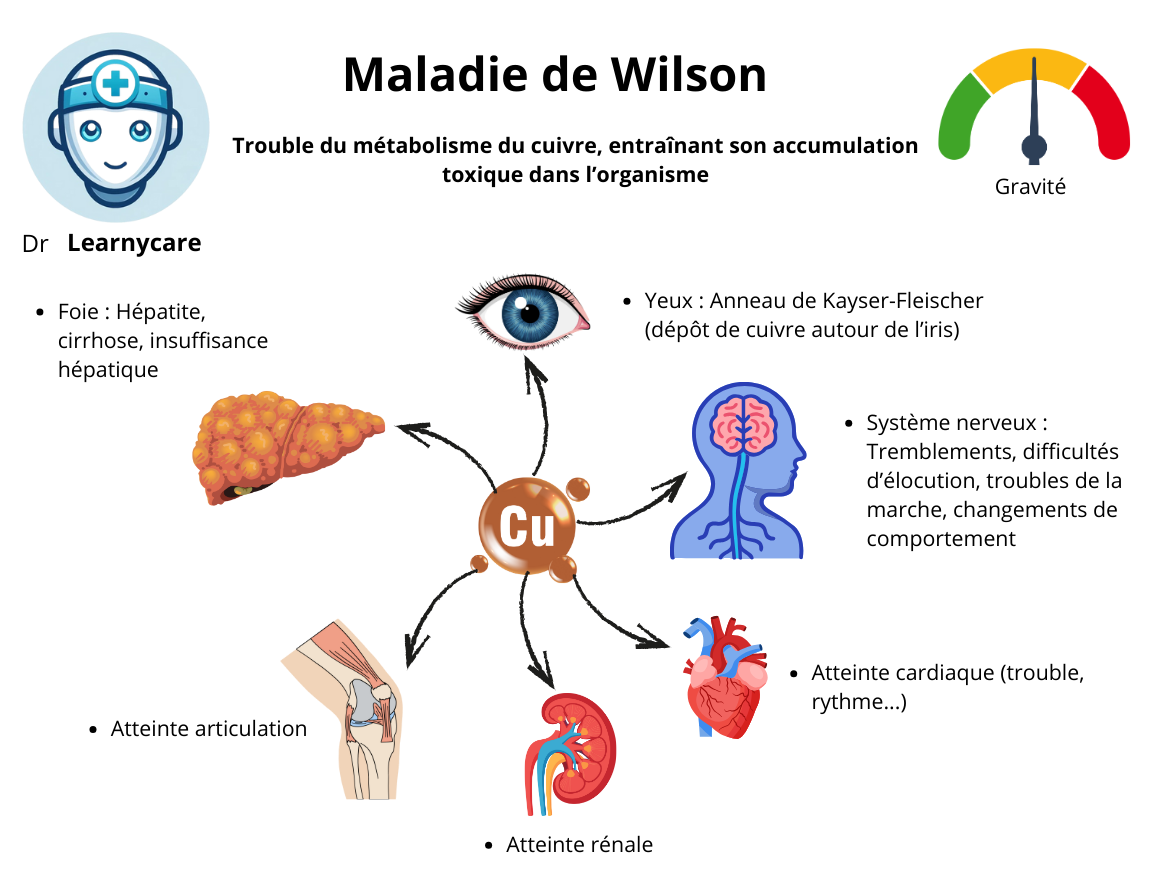 Maladie de Wilson infographie Dr Learnycare