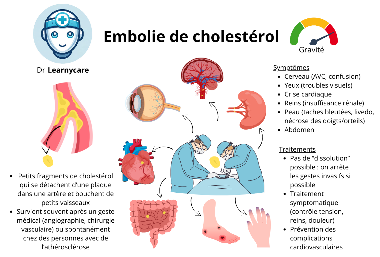 Embolie de cholestérol infographie Dr Learnycare