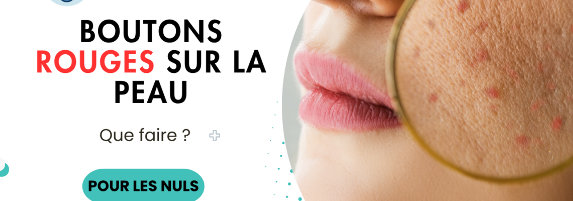 Boutons rouges sur la peau : causes, maladies possibles et quand s’inquiéter