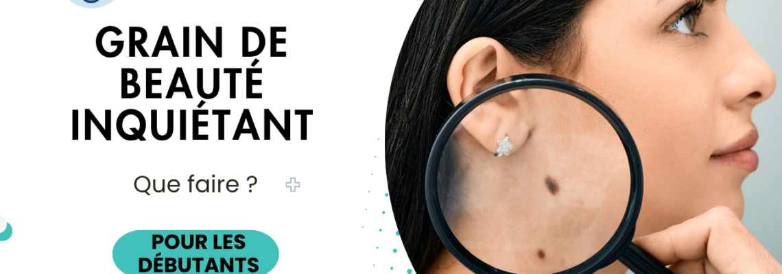 Grain de beauté inquiétant : comment reconnaître un mélanome et quand consulter ?