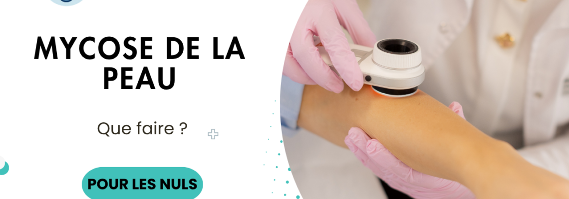 Mycose cutanée : symptômes, causes, traitement et comment s’en débarrasser